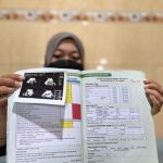Wajib USG, Kelainan Janin Terdeteksi Lebih Dini di Kota Jogja