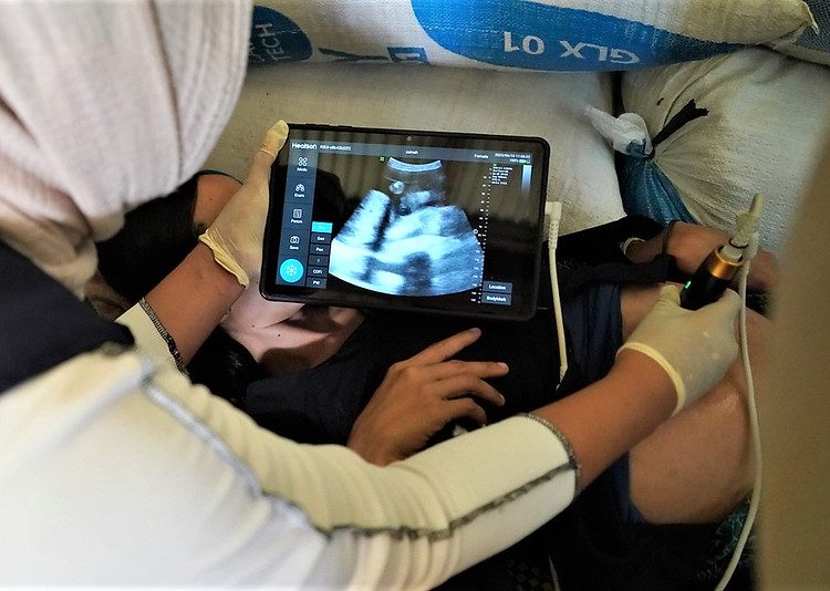 USG Bantu Pemeriksaan Kesehatan Ibu Hamil di Badui Dalam