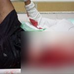 Polisi Buru Gerombolan Remaja Penganiaya Dua Pemuda di Sukolilo Pati