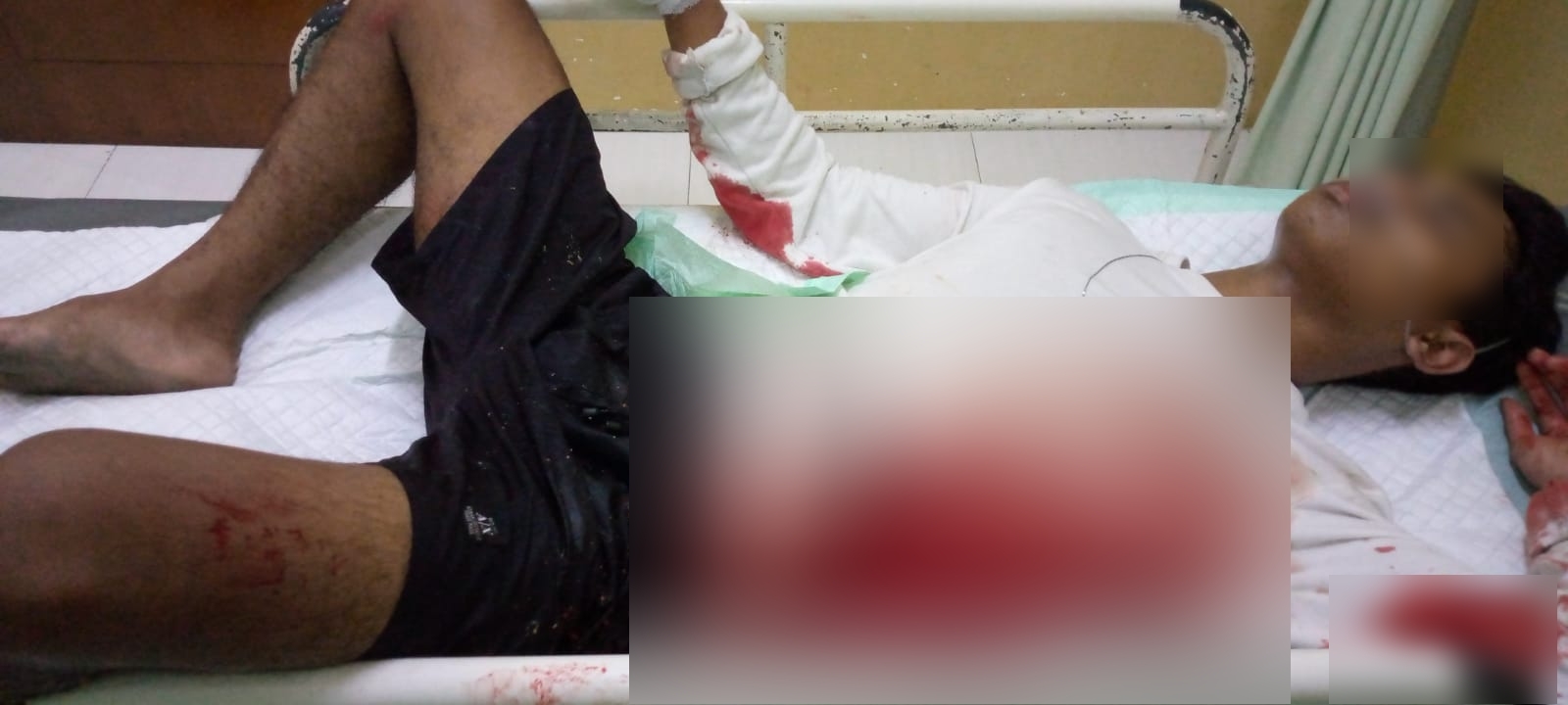 Polisi Buru Gerombolan Remaja Penganiaya Dua Pemuda di Sukolilo Pati
