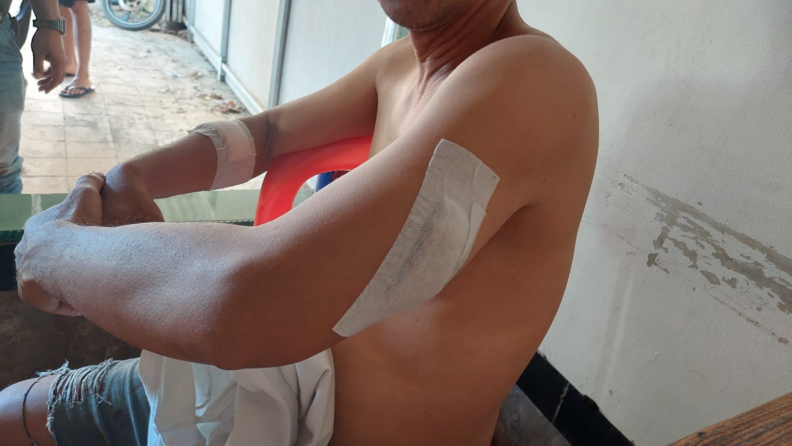 Begini Kronologi Jurnalis Ditikam Usai Beritakan Kasus Korupsi Bandara Kargo